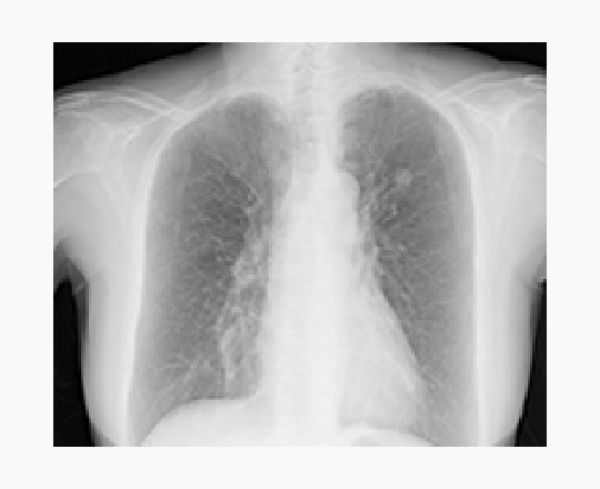 画像処理 / 診断支援サービス